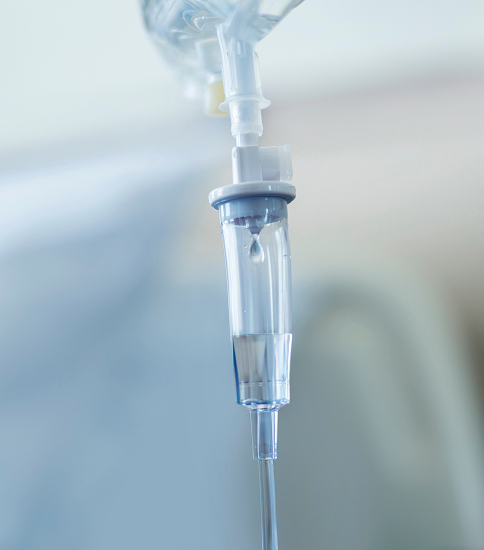 체외충격파치료